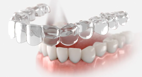 Orthodontic Treatment via Invisalign®